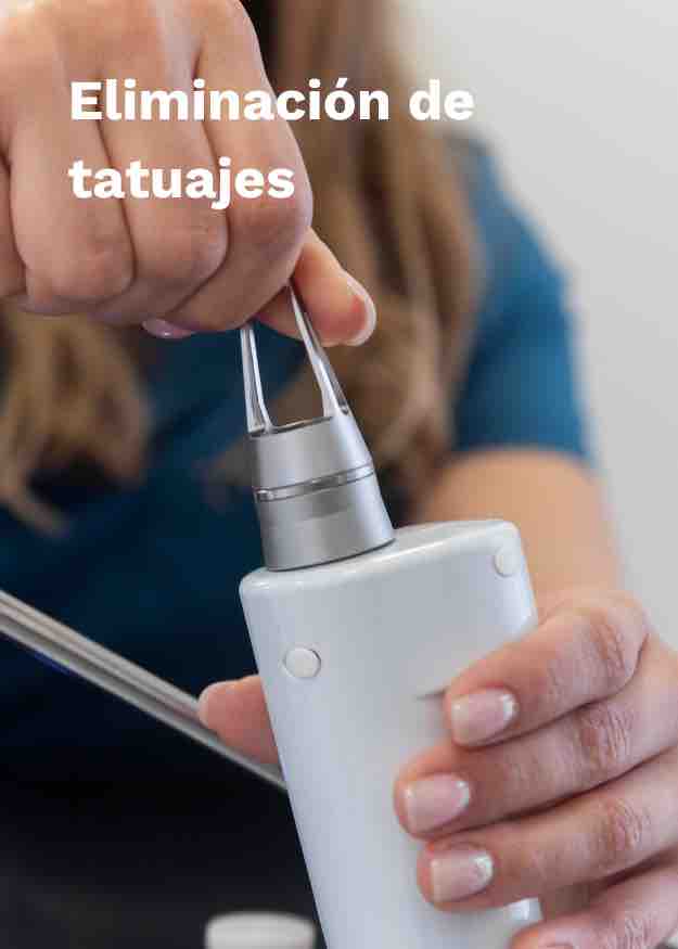 Imagen eliminacion de tatuajes en la cara